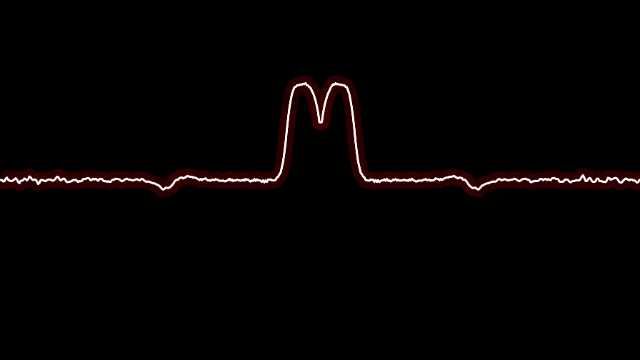 Lagrangian wave equation 